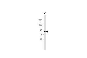 Anti-SUZ12 Antibody (C-term) at 1:2000 dilution + F9 whole cell lysate Lysates/proteins at 20 μg per lane.