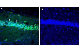 Expression of IGF1 in mouse hippocampus. (IGF1 anticorps  (Secreted))