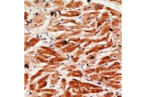 Immunohistochemical analysis of Granzyme A staining in human heart formalin fixed paraffin embedded tissue section. (GZMA anticorps)
