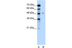 WB Suggested Anti-CHGA Antibody Titration:  0. (Chromogranin A anticorps  (C-Term))