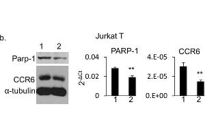 CCR6 expression in PARP-1 knockdown human cells.