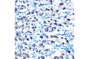 Immunohistochemistry of paraffin-embedded rat stomach using DMT1 Rabbit pAb (ABIN6129471, ABIN6147839, ABIN6147840 and ABIN6214400) at dilution of 1:100 (40x lens).