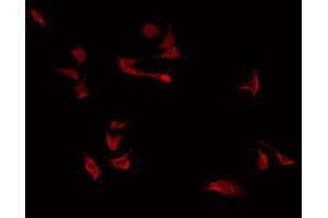 ABIN6266792 staining Hela by IF/ICC. (FKBPL anticorps  (Internal Region))