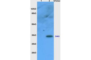 Lane 1: mouse liver lysates Lane 2: mouse thymus lysates probed with Anti CD1A Polyclonal Antibody, Unconjugated (ABIN1386771) at 1:200 in 4 °C.
