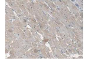 Detection of CES1 in Rat Heart Tissue using Polyclonal Antibody to Carboxylesterase 1 (CES1)