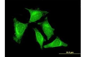 Immunofluorescence of monoclonal antibody to RASGEF1C on HeLa cell. (RASGEF1C anticorps  (AA 168-260))