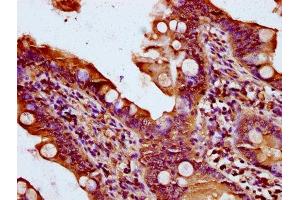 IHC image of ABIN7170939 diluted at 1:400 and staining in paraffin-embedded human small intestine tissue performed on a Leica BondTM system.