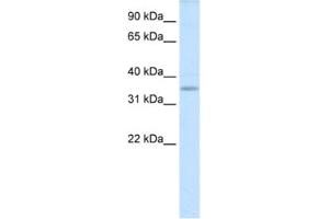 Western Blotting (WB) image for anti-TGFB-Induced Factor Homeobox 2-Like, X-Linked (TGIF2LX) antibody (ABIN2461543) (TGIF2LX anticorps)