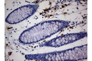 Image no. 3 for anti-Paternally Expressed 3 (PEG3) (AA 1-364) antibody (ABIN1490765)