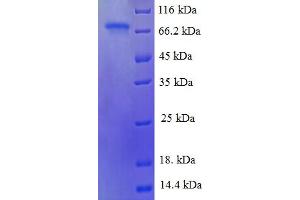 SDS-PAGE (SDS) image for Activating Transcription Factor 2 (ATF2) (AA 1-505), (full length) protein (His-SUMO Tag) (ABIN5709095)