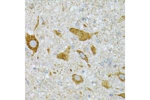 Immunohistochemistry of paraffin-embedded mouse spinal cord using ST3GAL3 antibody.