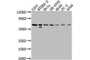 Western Blot Positive WB detected in: U251 whole cell lysate, NTERA-2 whole cell lysate, Hela whole cell lysate, SH-SY5Y whole cell lysate, HL60 whole cell lysate, PC-3 whole cell lysate, A549 whole cell lysate All lanes: CDK17 antibody at 1:2000 Secondary Goat polyclonal to rabbit IgG at 1/50000 dilution Predicted band size: 60 kDa Observed band size: 60 kDa (CDK17 anticorps  (AA 337-523))