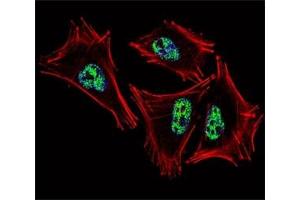 Fluorescent confocal image of A2058 cell stained with PROX1 antibody at 1:25.