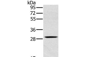 Western Blot analysis of Human testis tissue using CLIC1 Polyclonal Antibody at dilution of 1:400 (CLIC1 anticorps)