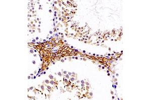 Immunohistochemistry of paraffin embedded mouse testis using SLC7A8 (ABIN7074503) at dilution of 1:1100 (400x lens)