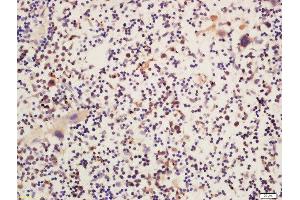 Formalin-fixed and paraffin embedded mouse spleen labeled with Rabbit Anti-Btk (Ser180) Polyclonal Antibody  at 1:200 followed by conjugation to the secondary antibody and DAB staining