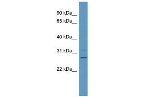 WB Suggested Anti-PSPH Antibody Titration: 0.