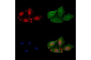 ABIN6262343 and ABIN6279489 staining  cells by IF/ICC. (HOXB3 anticorps  (C-Term))