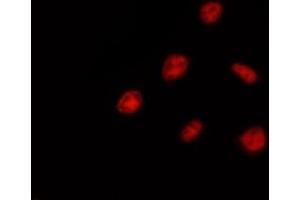 ABIN6275398 staining Hela by IF/ICC. (DDX52 anticorps  (C-Term))