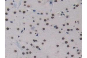 Detection of ENG in Mouse Cerebrum Tissue using Polyclonal Antibody to Endoglin (ENG)