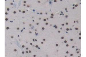 Detection of ENG in Mouse Cerebrum Tissue using Polyclonal Antibody to Endoglin (ENG) (Endoglin anticorps  (AA 27-137))