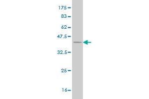 Western Blot detection against Immunogen (37.