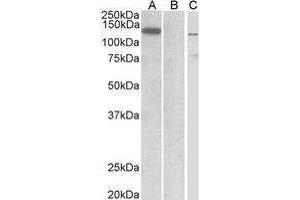 Western Blotting (WB) image for anti-Mindbomb E3 Ubiquitin Protein Ligase 1 (MIB1) (Internal Region) antibody (ABIN2475692) (MIB1 anticorps  (Internal Region))