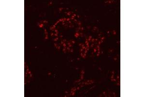 IF analysis of HnRNP H/HNRNPH1 using anti-HnRNP H/HNRNPH1 antibody (ABIN4886623). (HNRNPH1 anticorps  (N-Term))