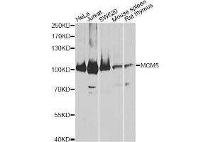 Western blot analysis of extracts of various cell lines, using MCM5 antibody (ABIN5973237) at 1:3000 dilution. (MCM5 anticorps)