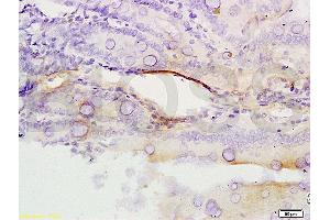 Formalin-fixed and paraffin embedded rat colon tissue labeled with Anti-ERCC1 Polyclonal Antibody, Unconjugated (ABIN733553) at 1:200 followed by conjugation to the secondary antibody, (SP-0023), and DAB staining