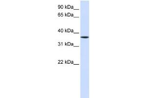 WB Suggested Anti-LHX8 Antibody Titration:  0. (LHX8 anticorps  (Middle Region))