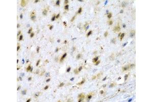 Immunohistochemistry of paraffin-embedded Mouse brain using TPH2 Polyclonal Antibody at dilution of 1:200 (40x lens). (Tryptophan Hydroxylase 2 anticorps)