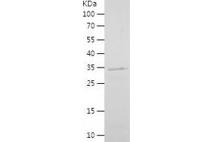 Western Blotting (WB) image for Lymphoid Enhancer-Binding Factor 1 (LEF1) (AA 120-399) protein (His tag) (ABIN7123803)