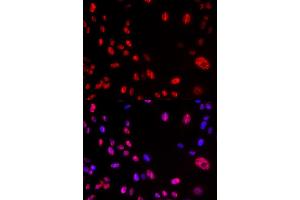 Immunofluorescence analysis of U2OS cells using Phospho-ATM-S1981 antibody (ABIN5969871). (ATM anticorps  (pSer1981))