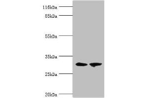 Western blot All lanes: ACBD4 antibody at 2 μg/mL Lane 1: Mouse kidney tissue Lane 2: Mouse liver tissue Secondary Goat polyclonal to rabbit IgG at 1/10000 dilution Predicted band size: 31, 35, 38 kDa Observed band size: 31 kDa (ACBD4 anticorps  (AA 1-305))