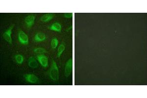 Peptide - +Immunofluorescence analysis of HeLa cells, using Calnexin (Ab-583) antibody. (Calnexin anticorps  (pSer583))