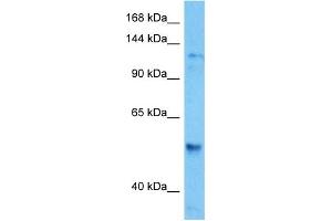Host:  Mouse  Target Name:  HDAC6  Sample Tissue:  Mouse Spleen  Antibody Dilution:  1ug/ml (HDAC6 anticorps  (C-Term))