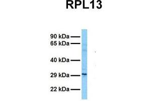 Host:  Rabbit  Target Name:  RPL13  Sample Tissue:  Human Fetal Lung  Antibody Dilution:  1. (RPL13 anticorps  (C-Term))