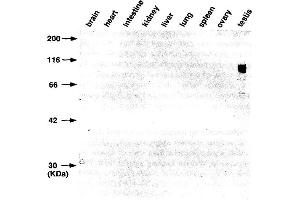 Western Blotting (WB) image for anti-Gena antibody (ABIN3201020) (Gena anticorps)