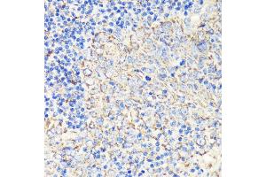 Immunohistochemistry of paraffin-embedded human tonsil using FKBP12 antibody (ABIN3022503, ABIN3022504, ABIN3022505 and ABIN6218864) at dilution of 1:200 (40x lens).