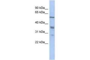 Western Blotting (WB) image for anti-Solute Carrier Family 38, Member 2 (SLC38A2) antibody (ABIN2463893) (SLC38A2 anticorps)