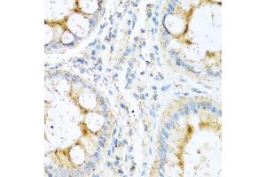 Immunohistochemistry of paraffin-embedded human colon using NTF4 antibody (ABIN1873968) at dilution of 1:100 (40x lens).