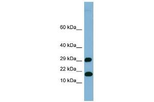 TRAPPC2L antibody used at 1 ug/ml to detect target protein.