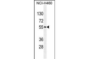Western blot analysis in NCI-H460 cell line lysates (35ug/lane). (MIER2 anticorps  (N-Term))