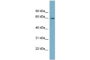 WB Suggested Anti-PGM3  Antibody Titration: 0.