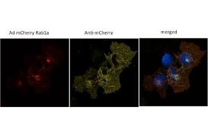 293 HEK cells transduced with Ad mCherry Rab1a and stained with anti-mCherry (mCherry anticorps)