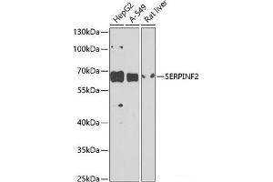 Western blot analysis of extracts of various cell lines using SERPINF2 Polyclonal Antibody at dilution of 1:1000. (alpha 2 Antiplasmin anticorps)