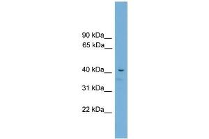 Mouse Muscle; WB Suggested Anti-Acd Antibody Titration: 0. (ACD anticorps  (C-Term))