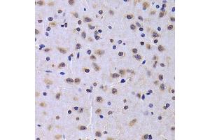 Immunohistochemistry of paraffin-embedded rat brain using NUDC antibody.