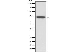 Western blot analysis of TNF Receptor II expression in Jurkat cell lysate.